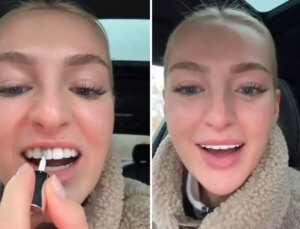 Dişlerini beyazlatmak için yaptığı akılalmaz!