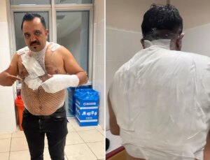 Deney yapmak isterken hayatının hatasını yaptı