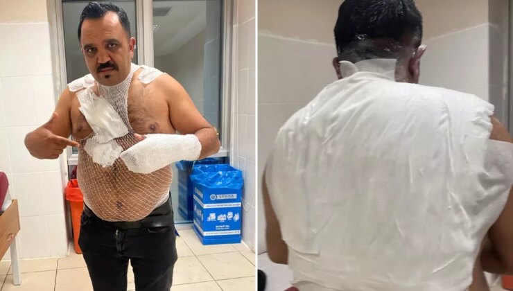 Deney yapmak isterken hayatının hatasını yaptı